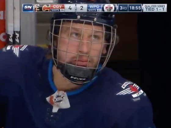 You Think Tucker Poolman Was Going To Let Blocking A Shot With His Face Stop Him From Playing? He's Too Hockey Tough For That