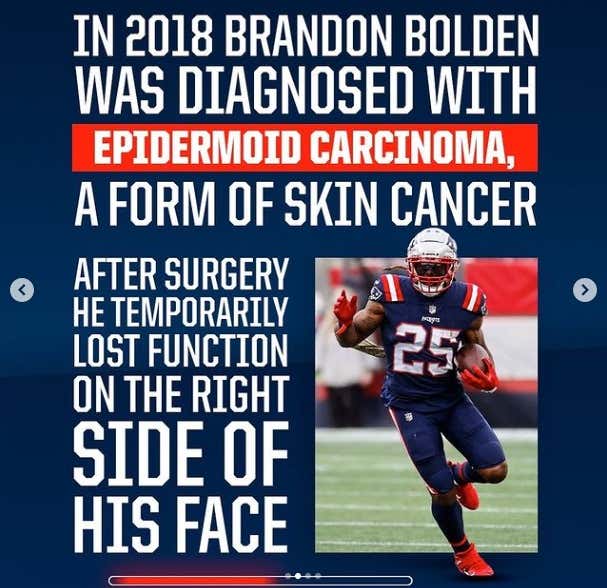 Cancer Couldn't Tackle Brandon Bolden - FOCUS