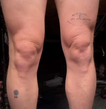 I'm Going to Be the Most Famous 34 Year Old on Tiktok