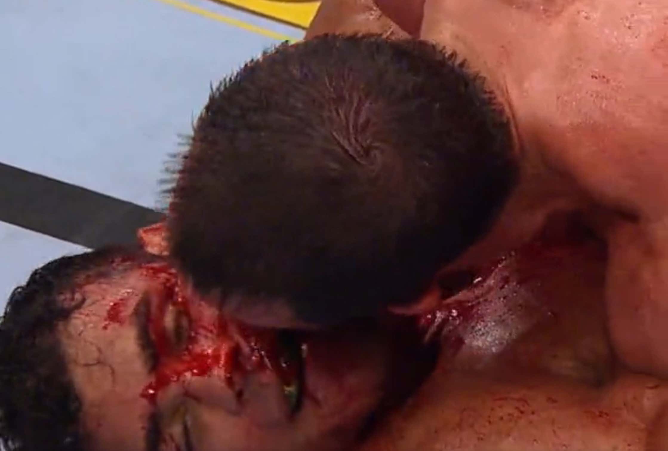 Luke Rockhold Just Smeared His Blood All Over Paulo Costa's Face To End Their Weird-Ass Fight