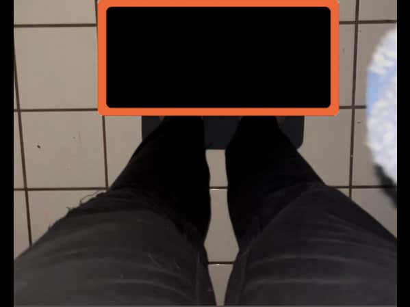 Chief Has The GNARLIEST Feet Of All Time