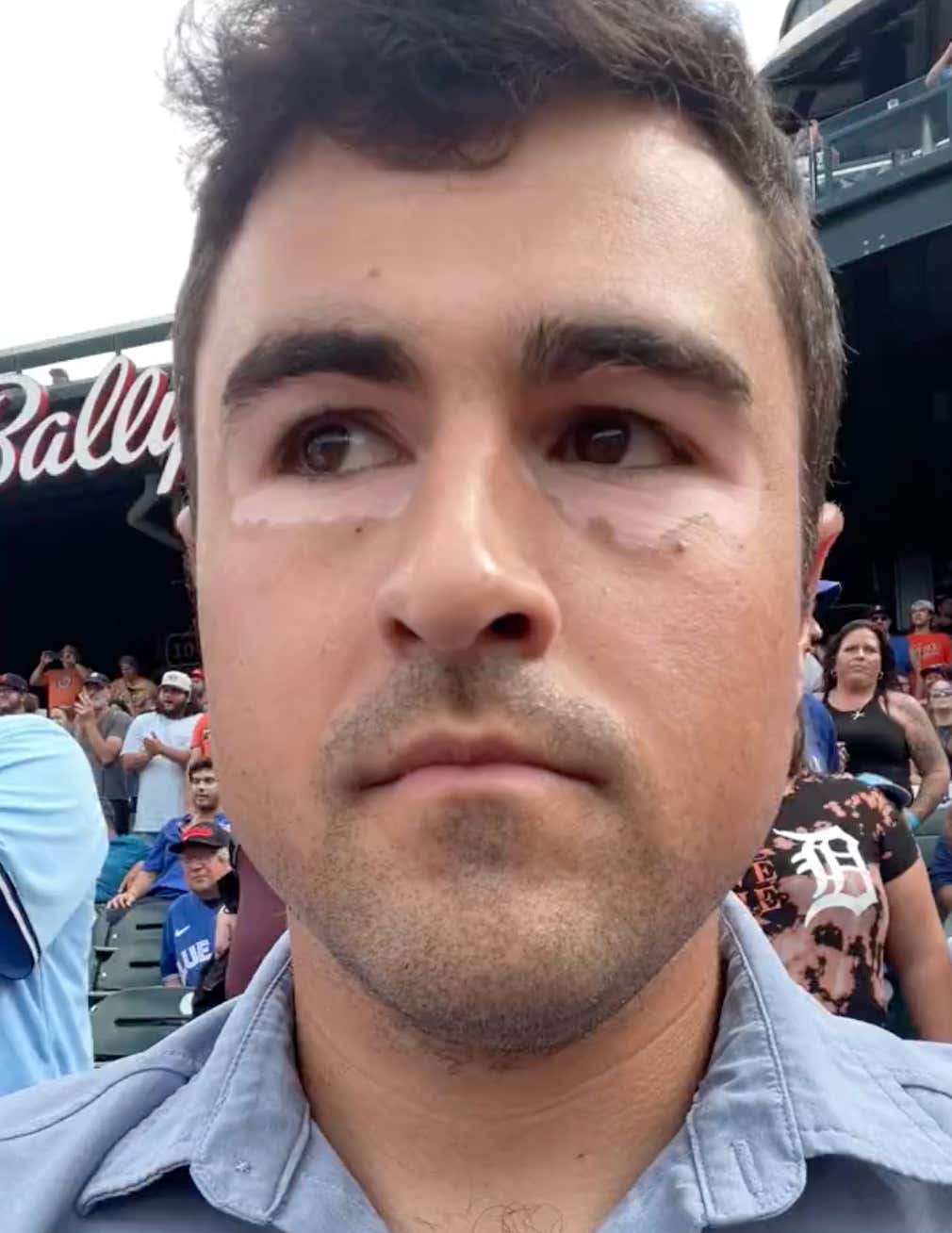 Explaining What The Hell Is Wrong With My Eyes