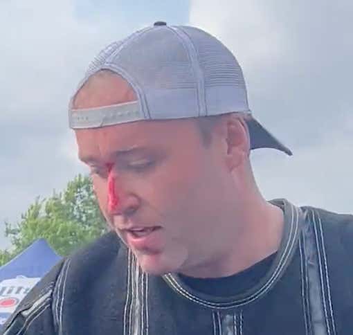 Addressing #VelcroFaceGate