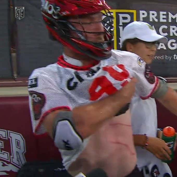 We Got A Brutal Reminder In The PLL This Weekend Of How Much Tougher Lacrosse Players Are Than Any Other Athletes On The Planet