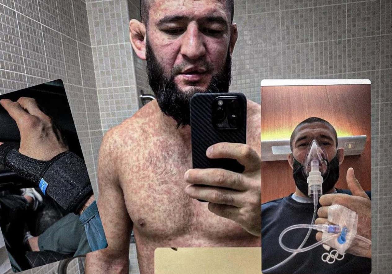 Khamzat Chimaev Posts Strange Photos Of Him Battling Sickness Where He Looks TERRIBLE