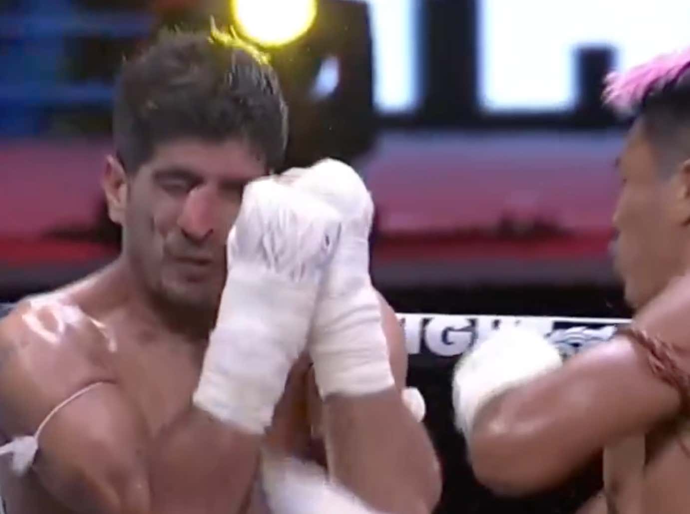 Muay Thai Fighter Puts His Opponent's Nose On The Side Of His Face With A Brutal Uppercut