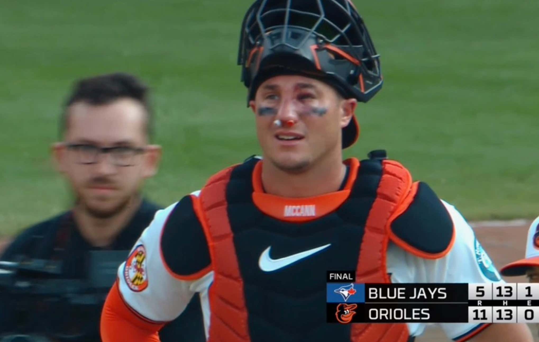 James McCann Took A 95 MPH Fastball To The Face, Caught A Full 9 Innings And Showed Why Baseball Players Are The Toughest Athletes Out There