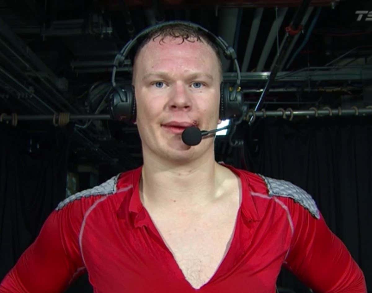 "Oh Jeez. Got A Face For Radio Right There" - Brady Tkachuk Might Not Get Many Modeling Gigs After Taking A Stick To The Face And Losing A Few Teeth