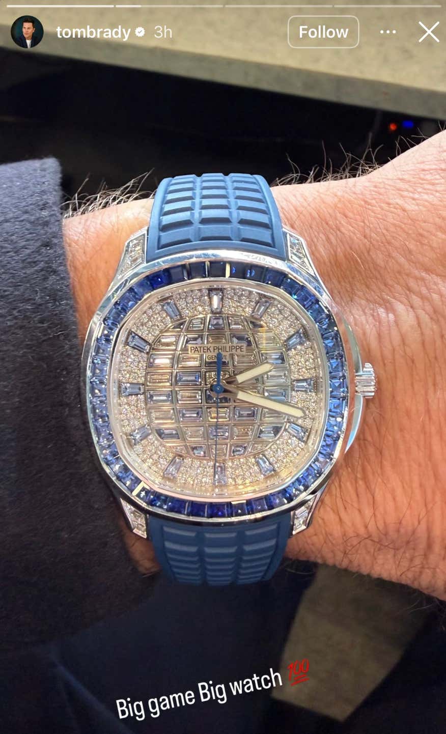 Tom Brady And His Watch Were The Biggest Losers Of Championship Sunday