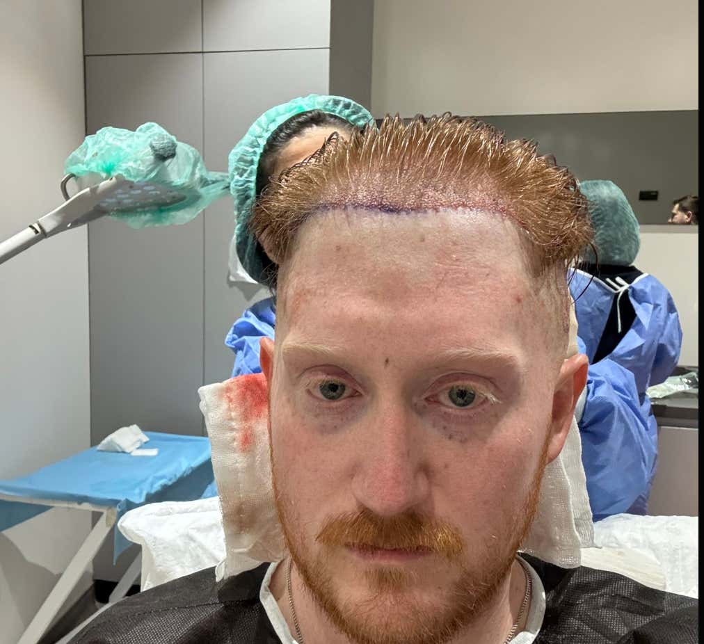 Seeing The Baldstool Boys Post Op Brings Me So Much Joy