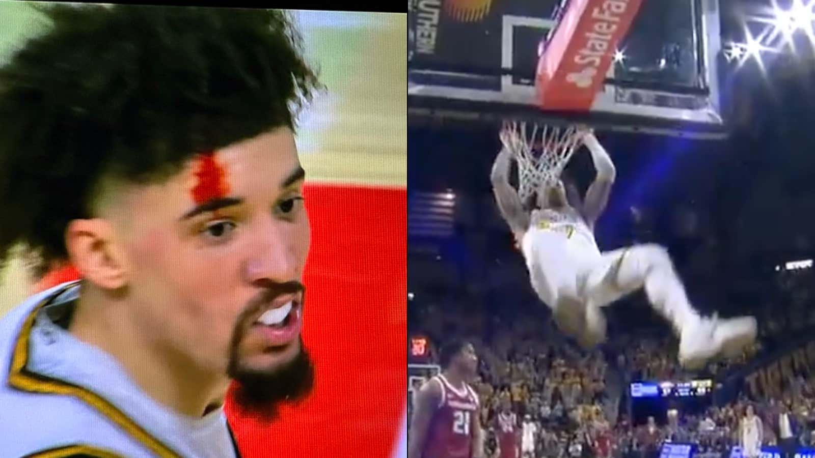 Mizzou's Jayden Stone Busted His Damn Head Open On The Rim While Dunking, Slaps A Headband On To Cover Up The Wound