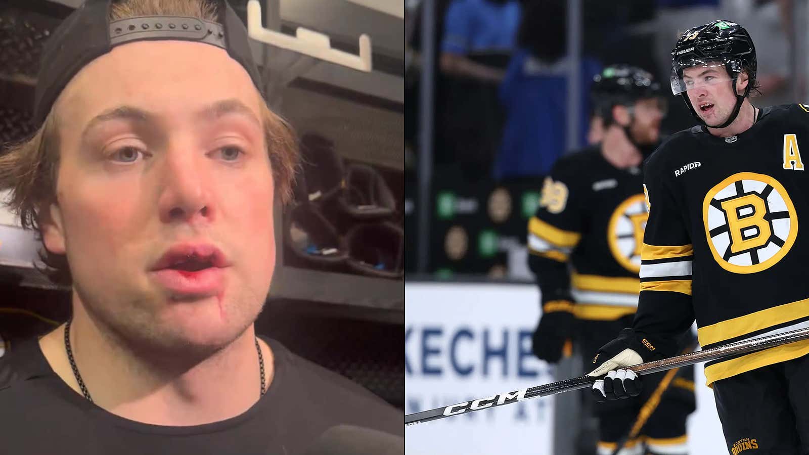 Charlie McAvoy Might Just Have To Become The First NHL Player To Wear A Fish Bowl Full Time