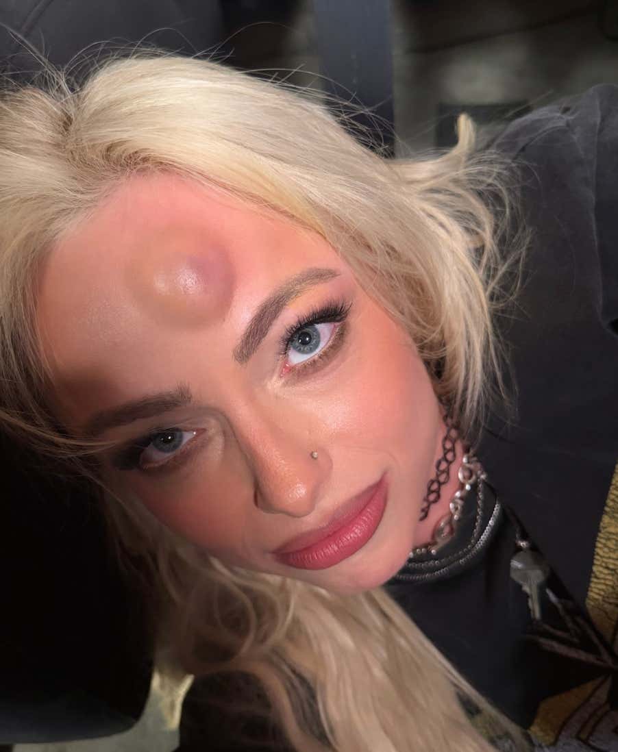 Liv Morgan Got An Insane Looney Tunes Style Bump On Her Forehead Following A Head Clash Last Night