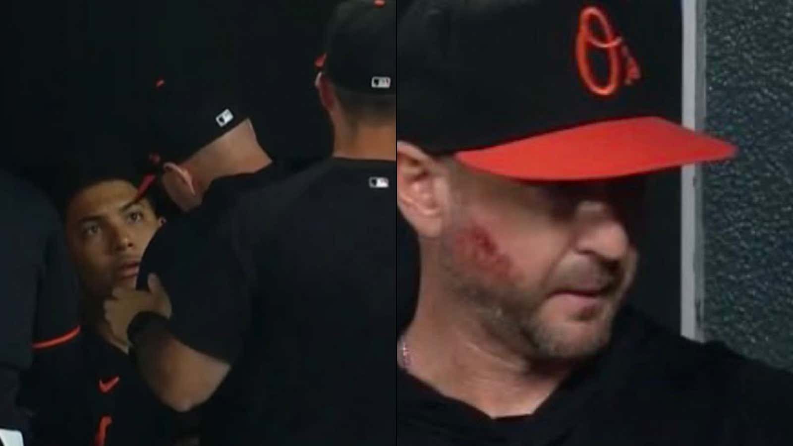 'He's Got A Big Set Of Balls On Him' - Craig Albernaz Won Over Every Single O's Player By Coming Back To The Dugout After Taking A Line Drive To The Face