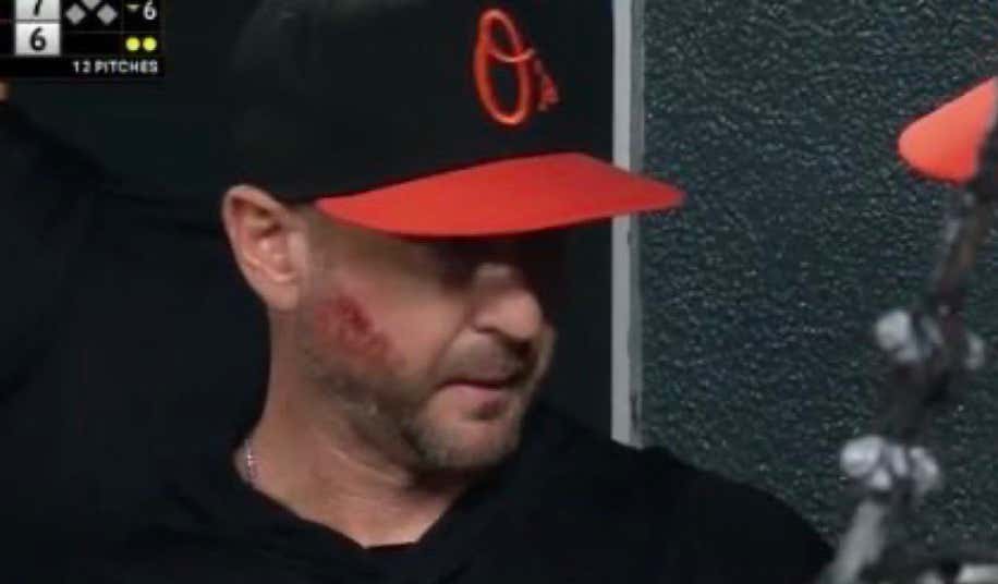 Scary Situation In Baltimore As Orioles' Manager Craig Albernaz Was Hit In The Face By A Foul Ball While Standing In The Dugout