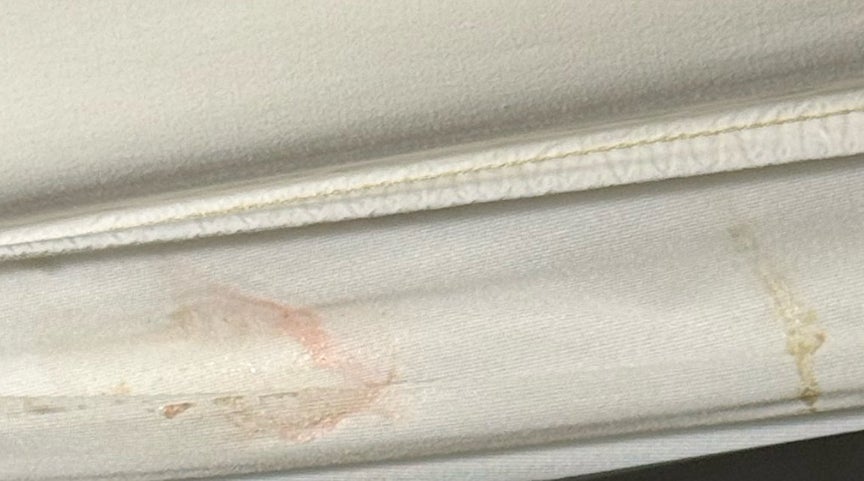 Mintzy And Tate May Have Bed Bugs