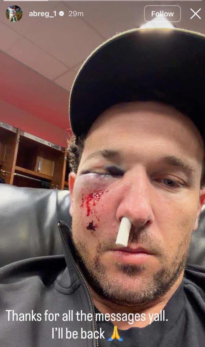 Alex Bregman Got Smoked In The Face With A Foul Ball While Waiting On Deck And The Pictures He's Posted Are Pretty Insane