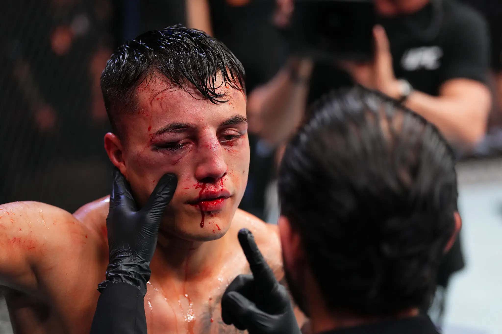 UFC Corner Tells Their Nearly Blinded Fighter: "You Don't Need Your Eyes! Just Fight!"