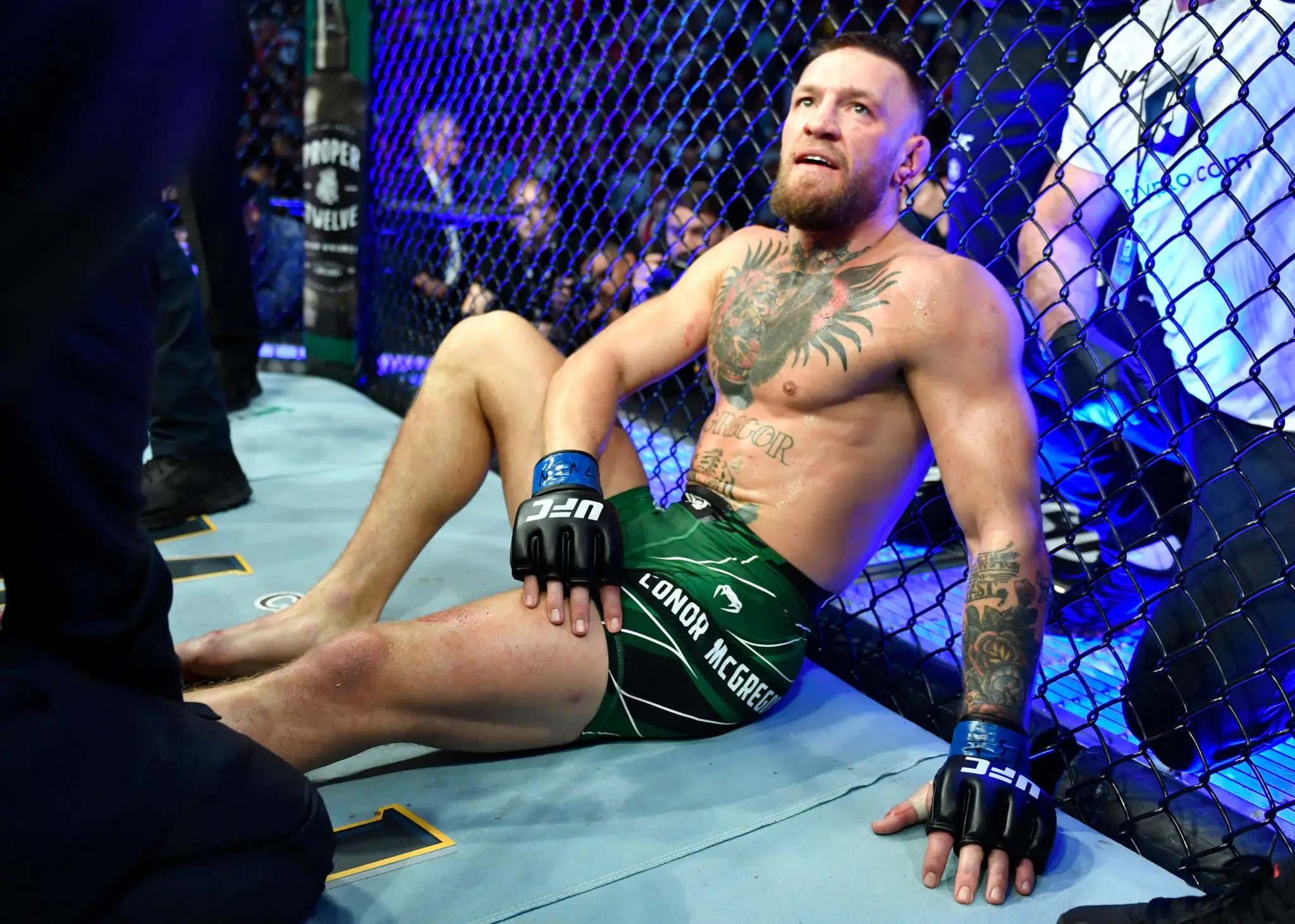 Conor McGregor Reveals Gruesome Images Of Broken Pinky Toe - Proving The Haters (And Losers) Wrong