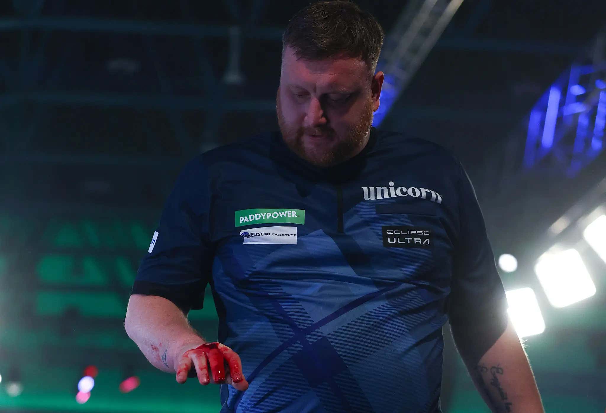 Left It All Out There - Cameron Menzies Handled His Loss At The World Darts Championship By Punching A Table And Putting Out Pyrotechnics With His Bare Hand