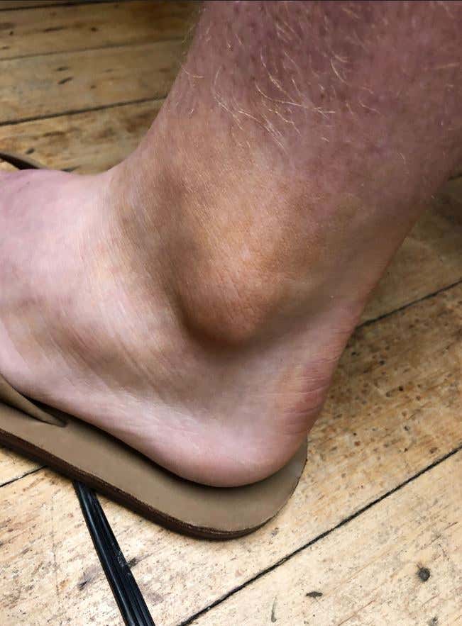 Breaking Office Manger Brett Puts Bronzer On His Ankles So They Look