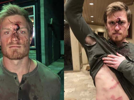 Roger Clemens' Son Is Suing A Bar Where He Got His Ass Kicked By A Bouncer On New Years Eve