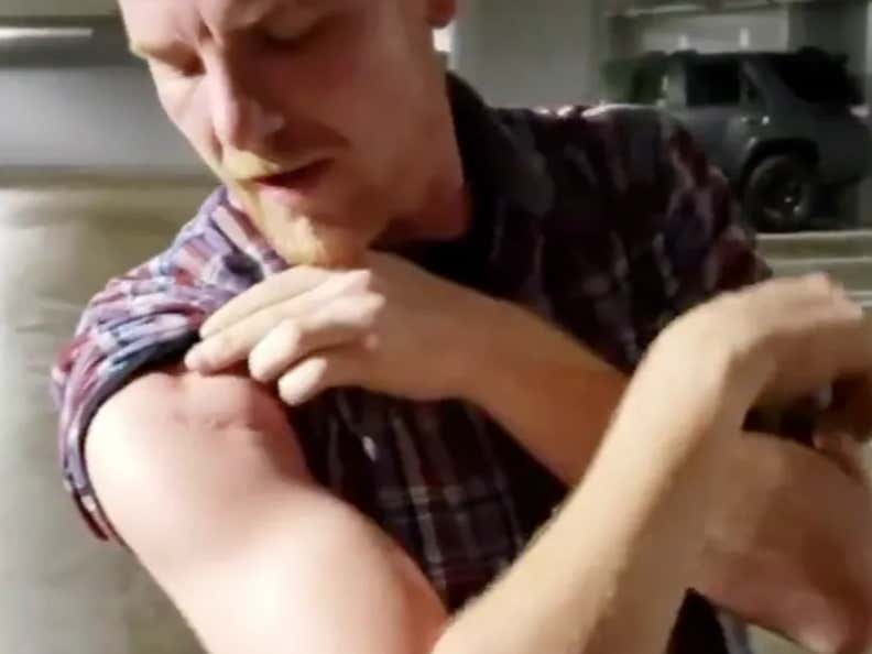 All These Streetfighting Scars Are More Proof That Fayetteville Is Beyond Bananaland