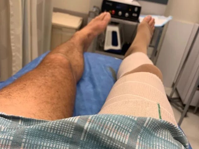I Had Surgery Today.   I Don’t Want Your Thoughts and Prayers Even Though I Need Them.  Instead Please Pray For the Koalas in Australia